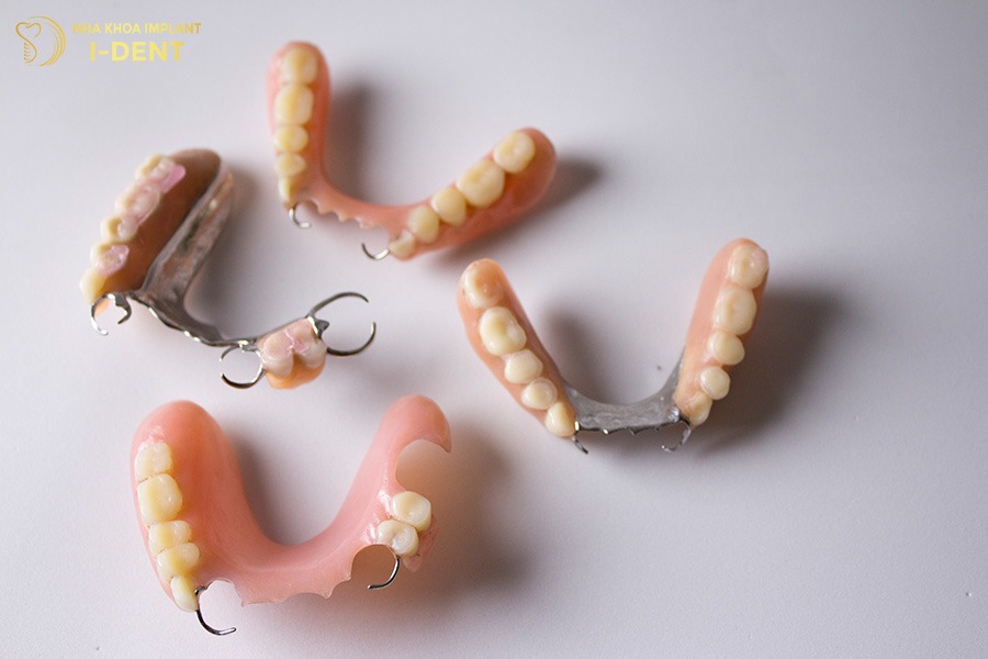 các cách trồng răng giả