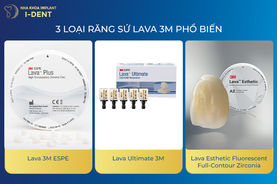3 loại răng sứ Lava 3M phổ biến răng sứ Lava Plus 3M ESPE