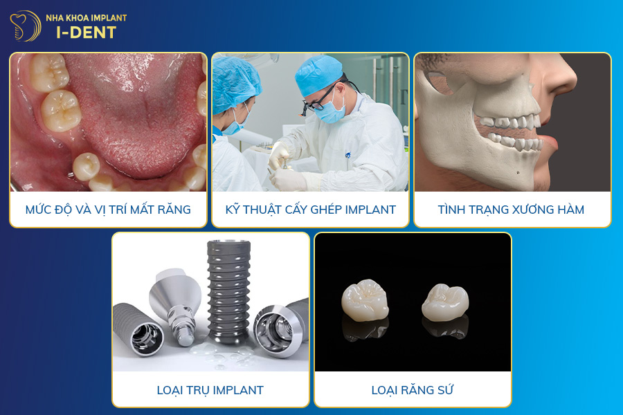 trồng implant giá