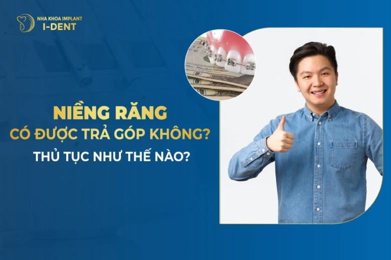 Niềng Răng Trả Góp 0% Lãi Suất Tại Nha Khoa I-Dent – TPHCM