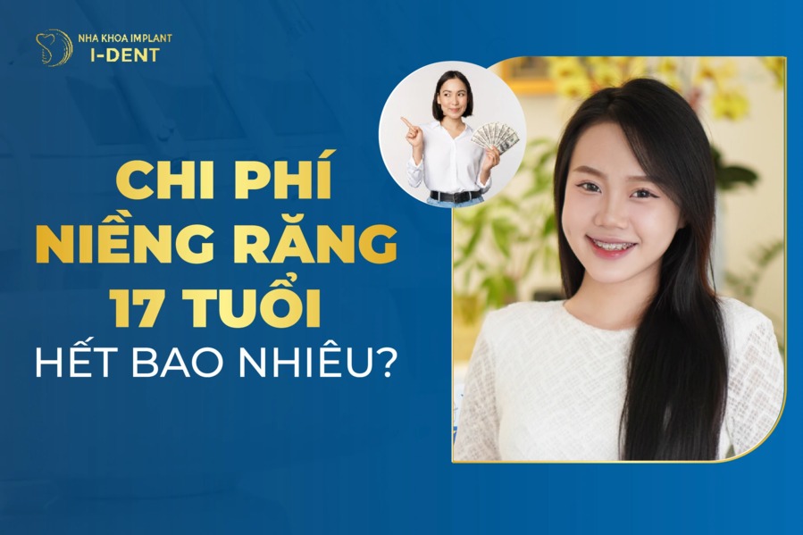 Trẻ 17 tuổi niềng răng bao nhiêu tiền? Mất bao lâu?