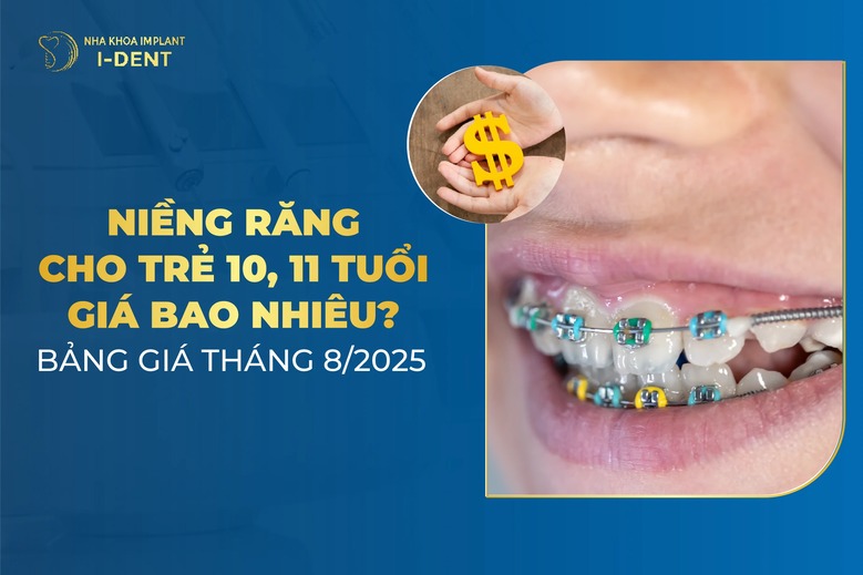 Niềng Răng Cho Trẻ 10 Tuổi Giá Bao Nhiêu? Bảng Giá Tháng 5/2026
