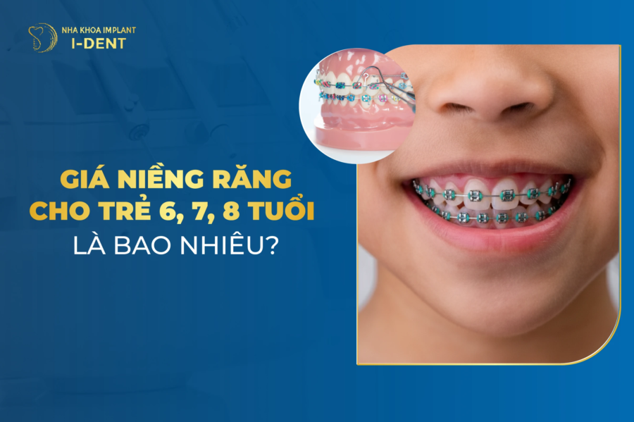 Giá niềng răng cho trẻ 7, 8 tuổi là bao nhiêu? Bảng giá 2026