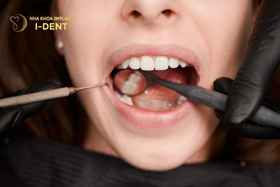 Nhổ răng số 5 vì mục đích niềng răng sẽ không gây ảnh hưởng