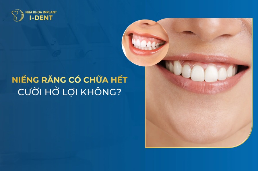 Niềng răng có hết hở lợi không? Phương pháp chữa cười hở lợi