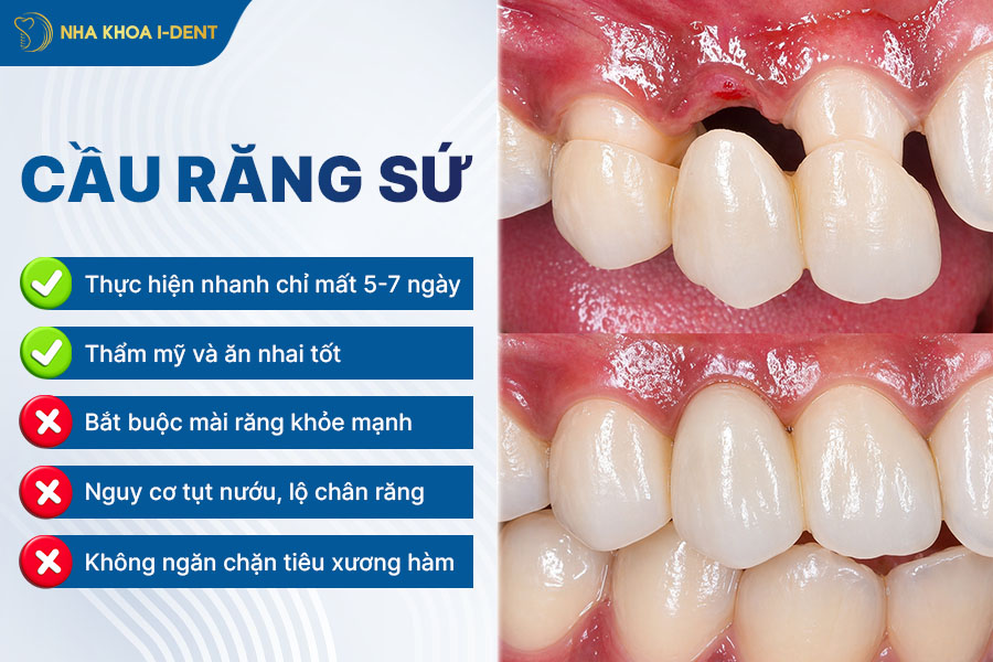 trồng răng không có chân răng được không