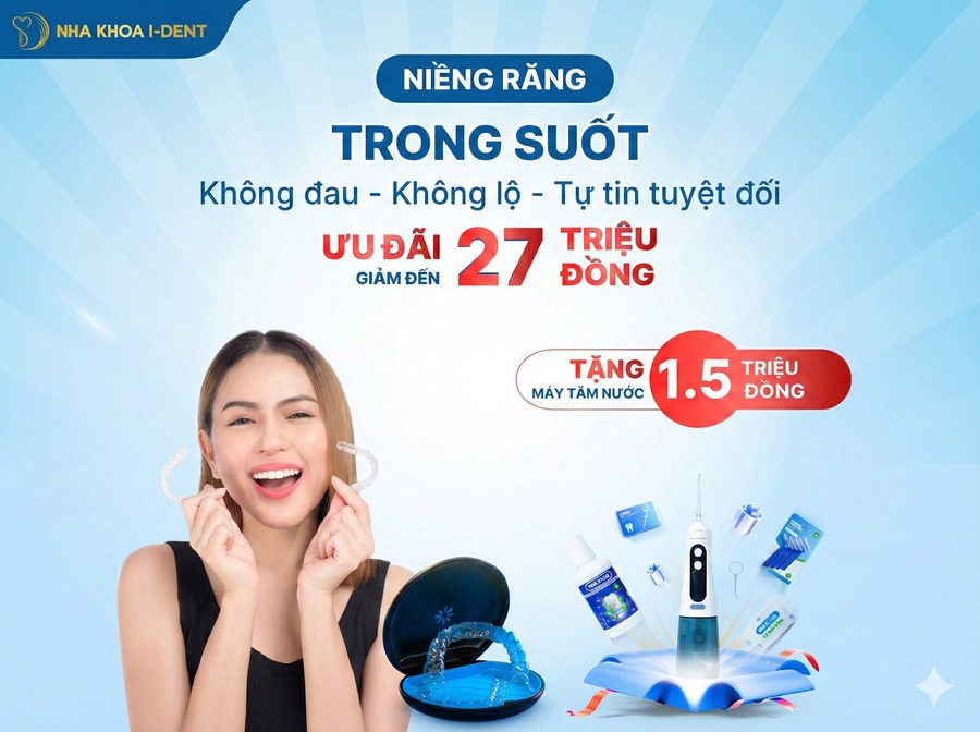 niềng răng để làm gì