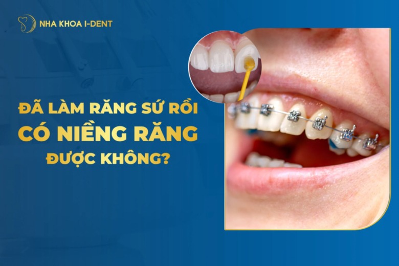 Đã Bọc Răng Sứ Rồi Có Niềng Răng Được Không?