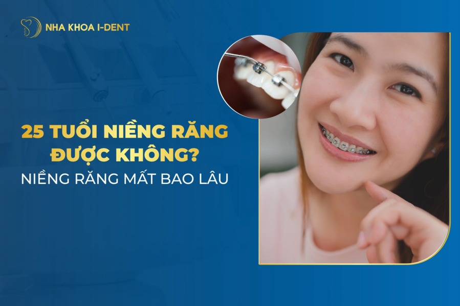 25 tuổi có niềng răng được không? Mất bao lâu?