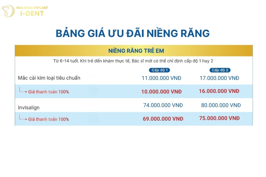 phí niềng răng