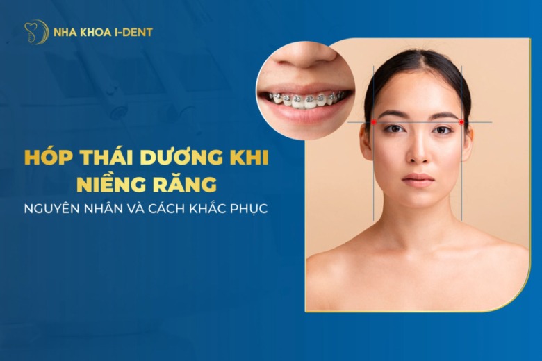 Nguyên nhân niềng răng hóp thái dương và cách khắc phục