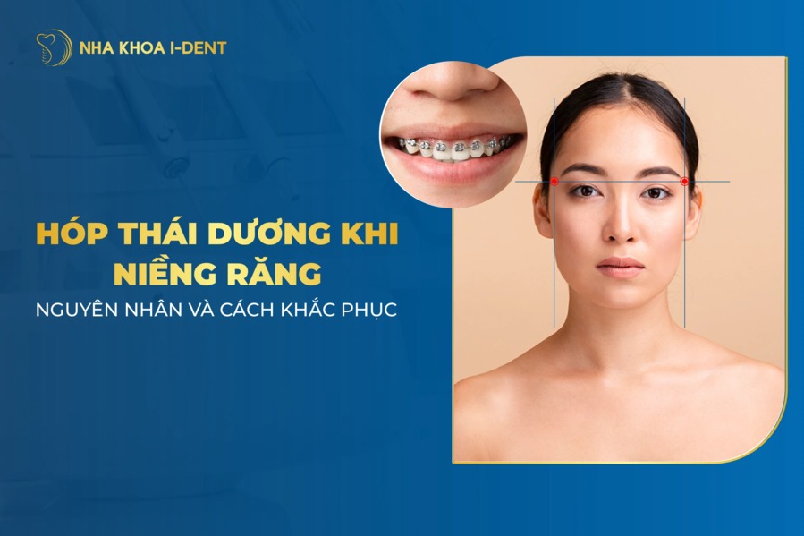 Nguyên nhân niềng răng hóp thái dương và cách khắc phục