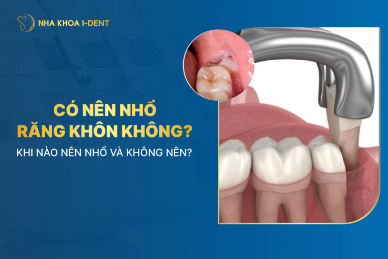 Có nhất thiết phải nhổ răng khôn không? Giải đáp chi tiết