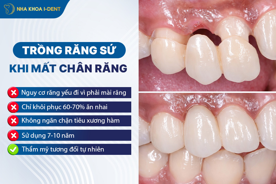 mất chân răng phải làm sao