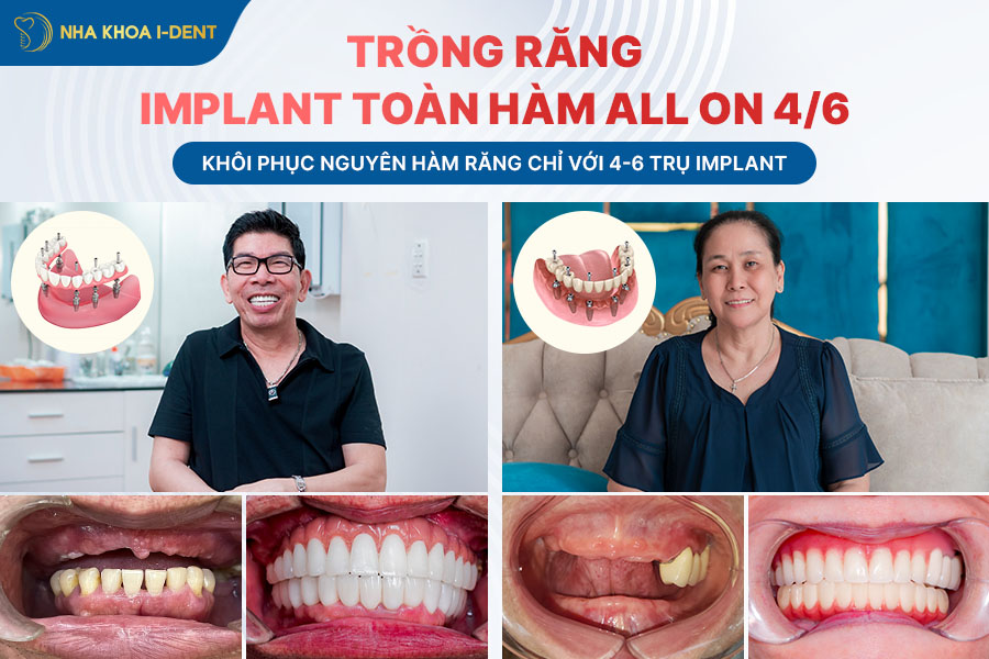 mất chân răng trồng được không
