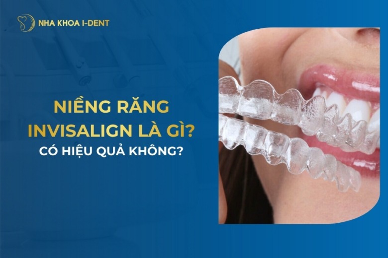 Niềng Răng Invisalign Là Gì? Giá, Quy Trình Và Hiệu Quả?