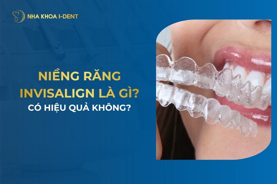Niềng Răng Invisalign Là Gì? Giá, Quy Trình Và Hiệu Quả?