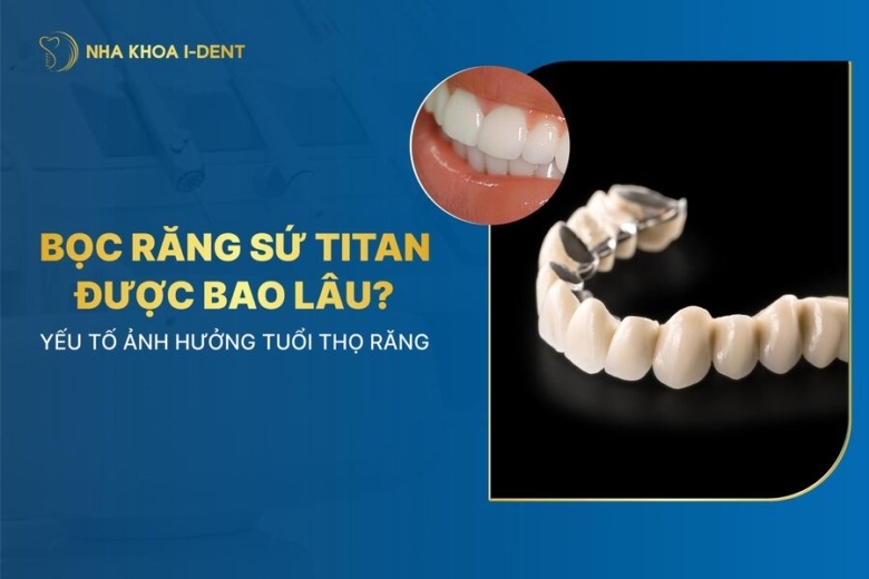 Bọc răng sứ Titan được bao lâu? Ưu điểm và nhược điểm