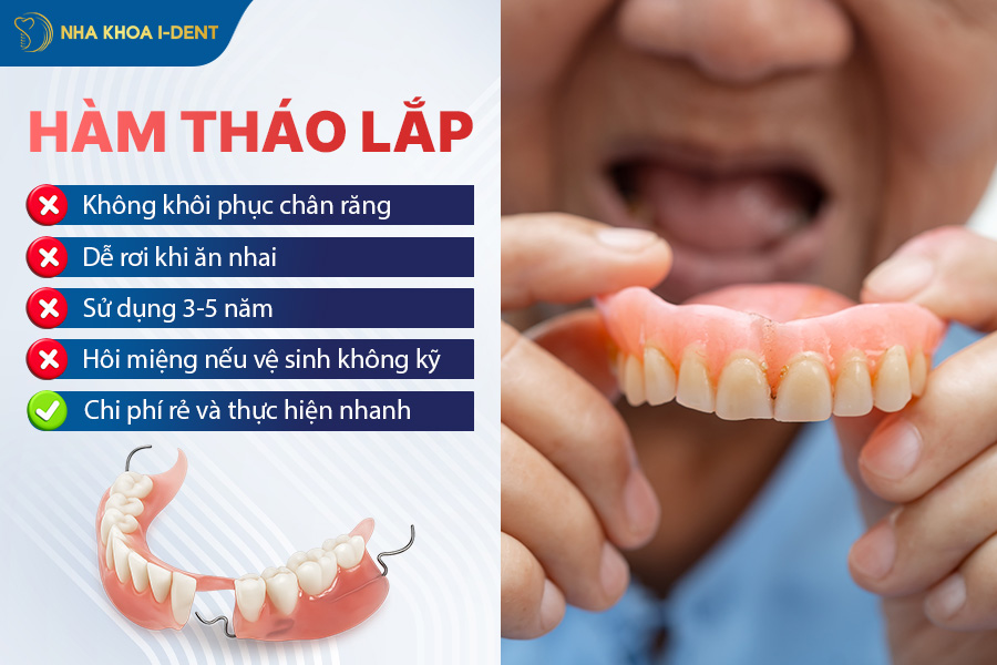 trồng răng khi mất chân răng