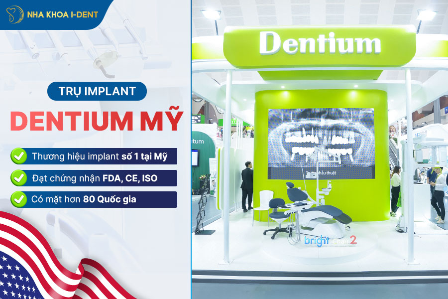 trụ implant dentium mỹ