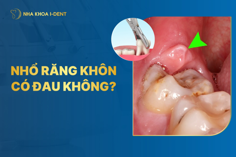 Tiểu phẫu nhổ răng khôn có đau không? Những lưu ý cần biết