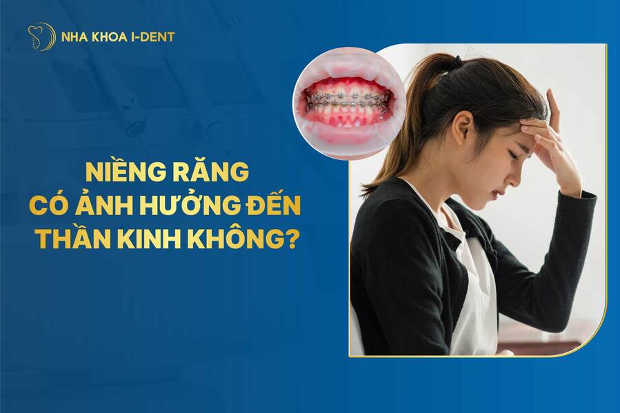 Niềng răng có ảnh hưởng đến thần kinh không? Bác sĩ giải đáp
