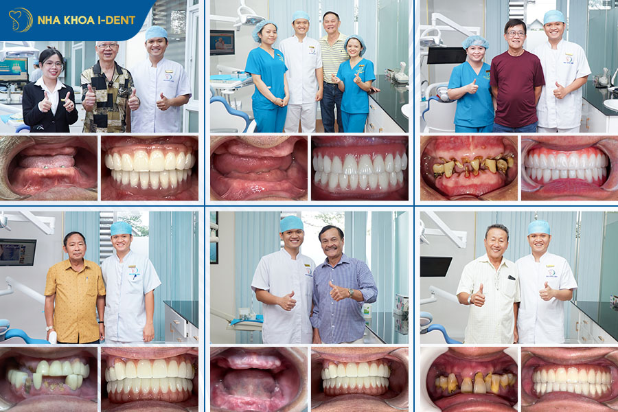 bác sĩ cấy implant giỏi tphcm