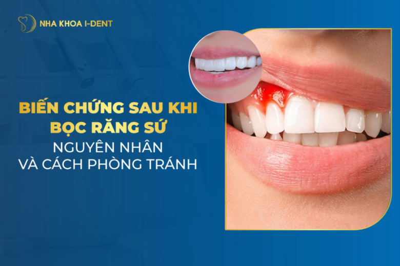 6 biến chứng sau khi bọc răng sứ có thể gặp