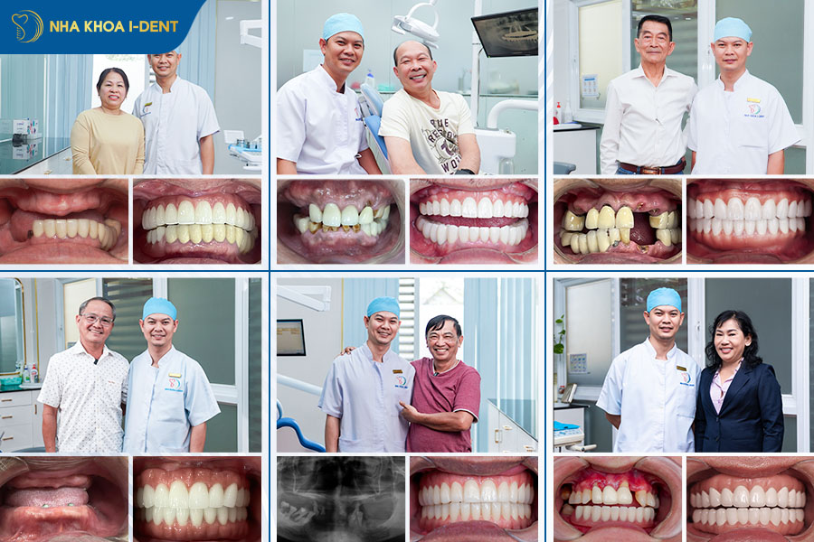 danh sách bác sĩ cấy implant giỏi tphcm