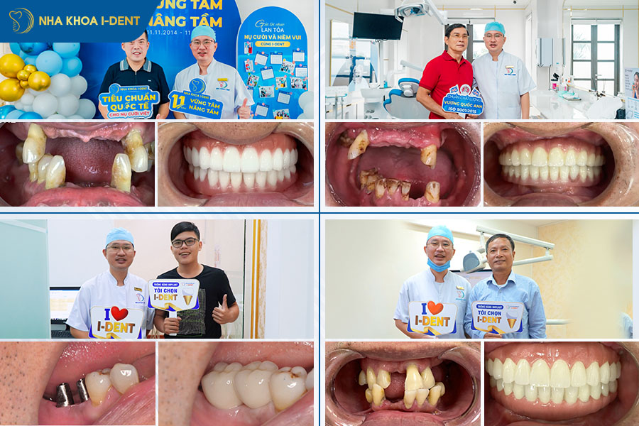 danh sách bác sĩ trồng implant giỏi