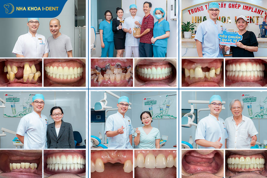 danh sách bác sĩ trồng implant tphcm