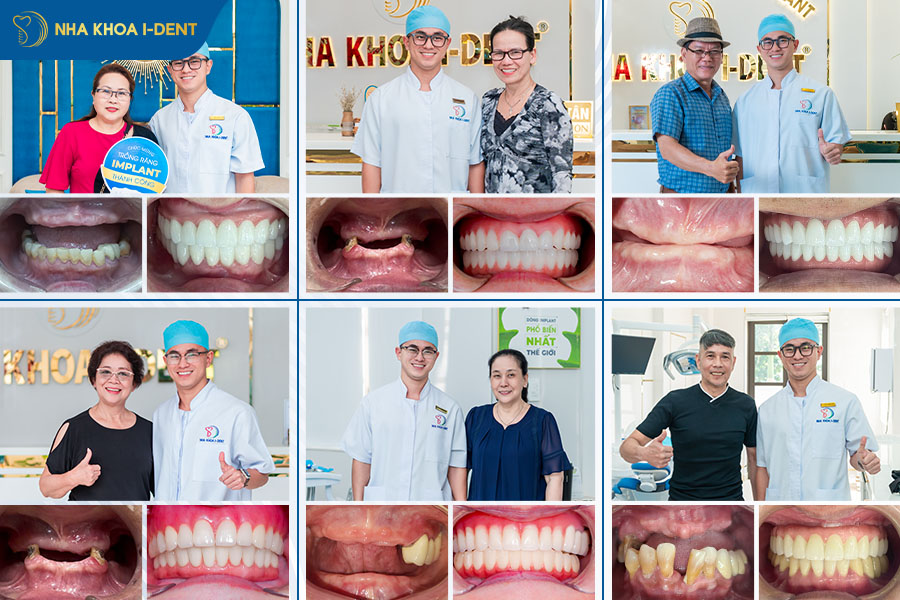 danh sách bác sĩ trồng răng implant giỏi tphcm