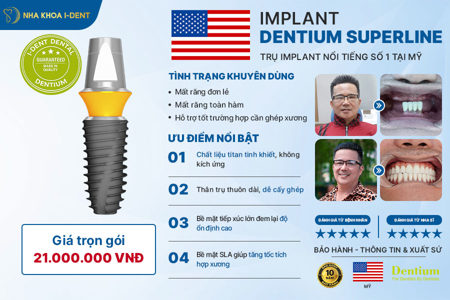implant kontact pháp