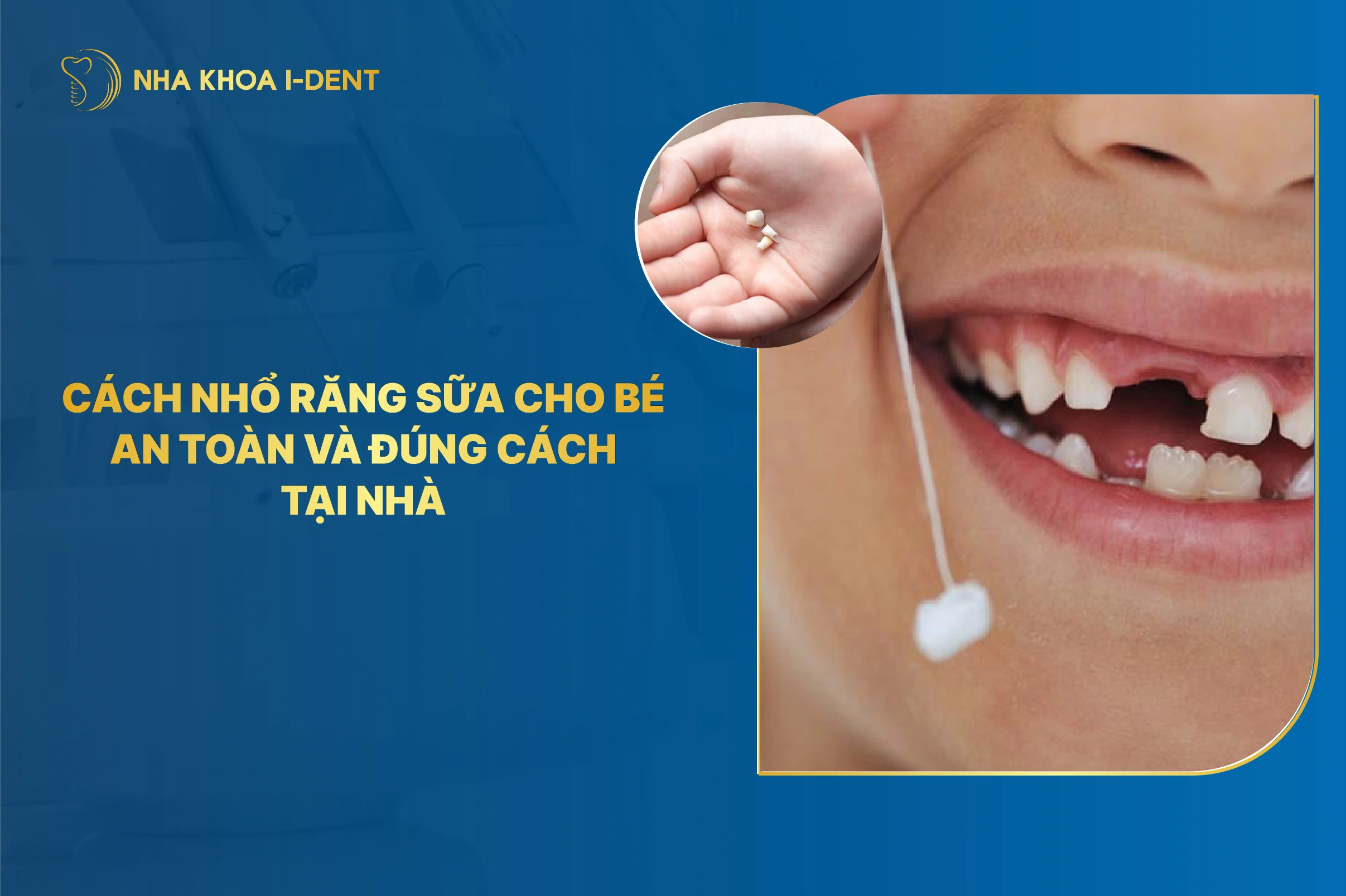 Cách nhổ răng sữa cho bé an toàn, không đau và ít chảy máu