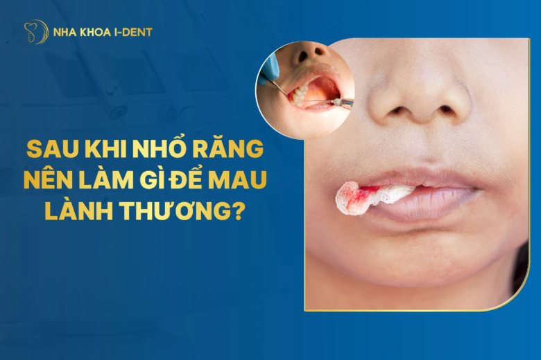Sau khi nhổ răng nên làm gì để mau lành thương?