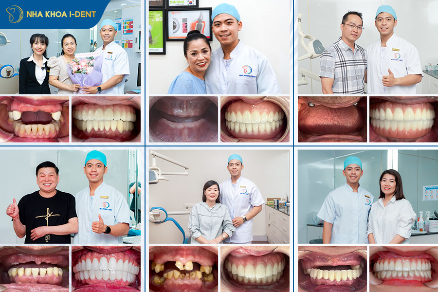 top bác sĩ cấy implant giỏi tphcm