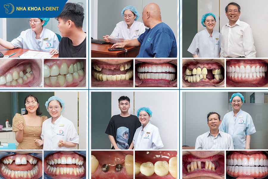 top bác sĩ trồng implant giỏi