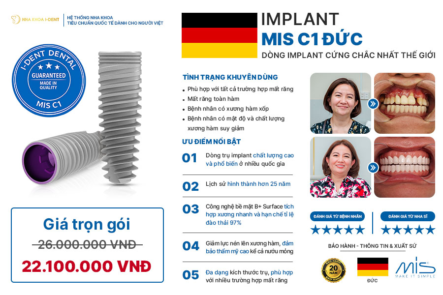 trụ implant kontact