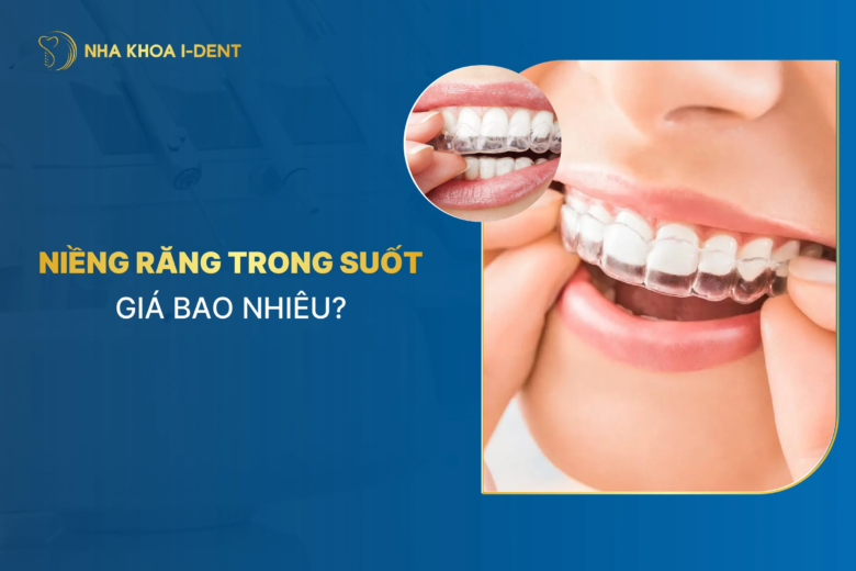 Niềng Răng Trong Suốt Giá Bao Nhiêu Tiền? Giá Niềng [5/2026]