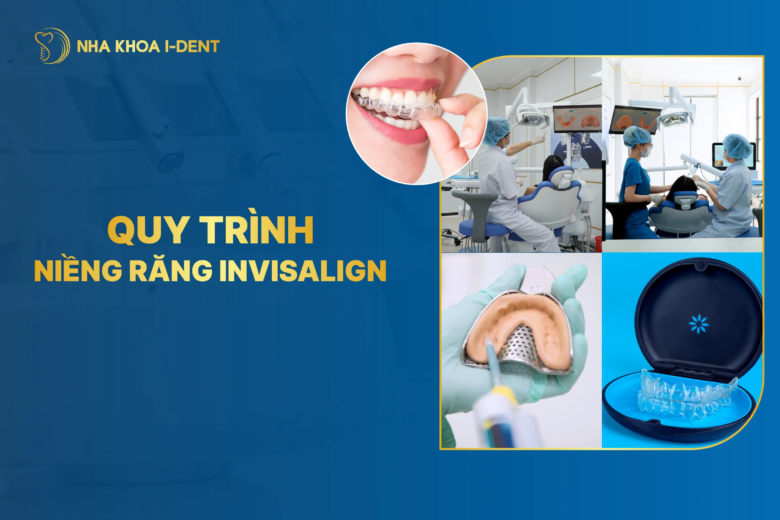 8 bước quy trình niềng răng trong suốt Invisalign