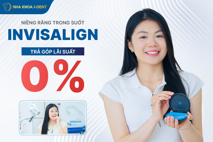 bảng giá niềng răng trong suốt