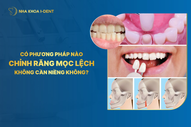 Top 4 cách chỉnh răng mọc lệch không cần niềng