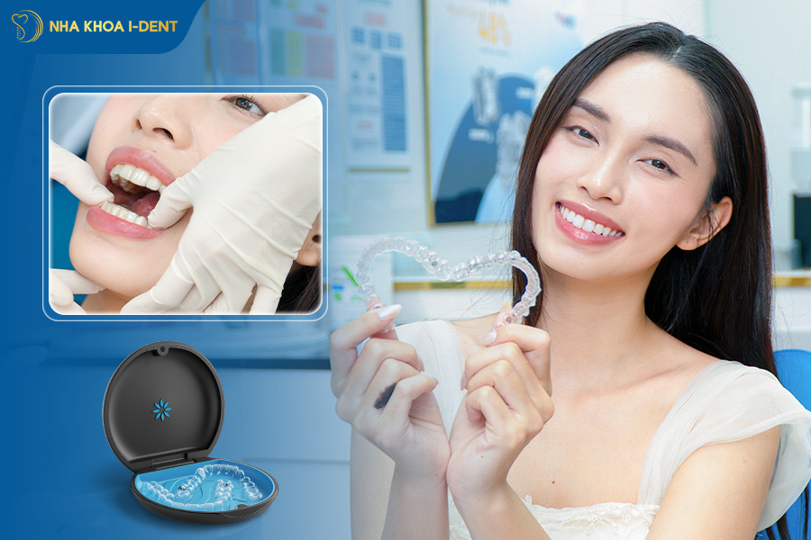 giá niềng răng trong suốt bao nhiêu tiền