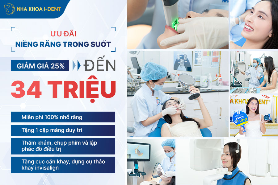 giá niềng răng trong suốt