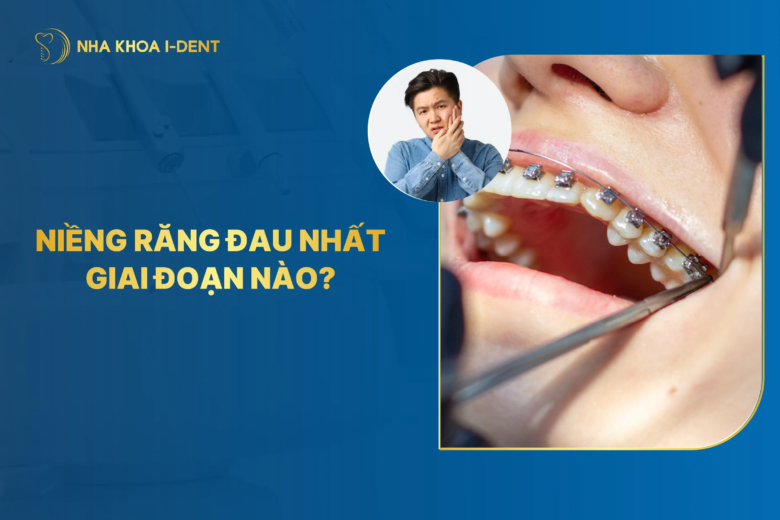 Giai đoạn đau nhất của niềng răng khi nào? Cách giảm đau