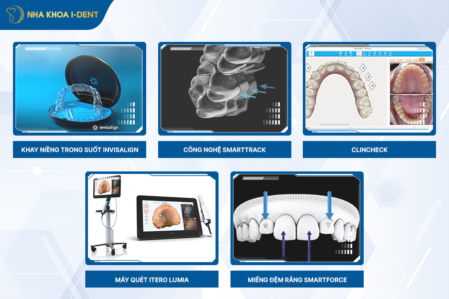 niềng răng trong suốt giá