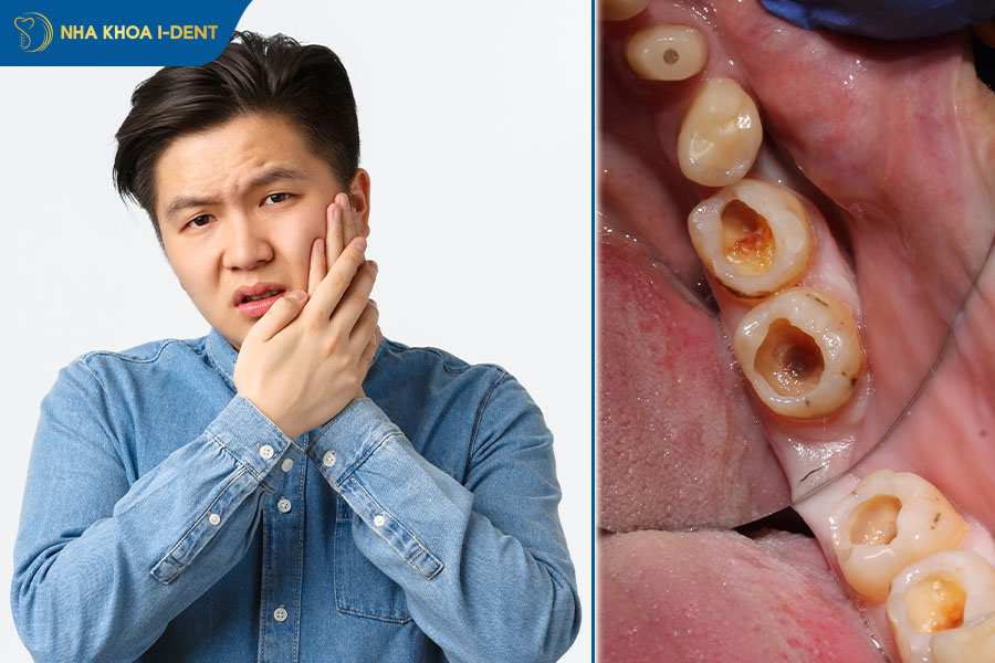 răng đang nhức có nhổ được không