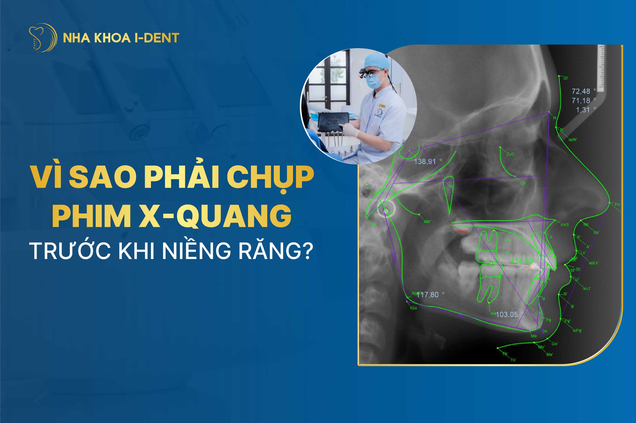 Tại sao phải chụp phim X-quang trước khi niềng răng?