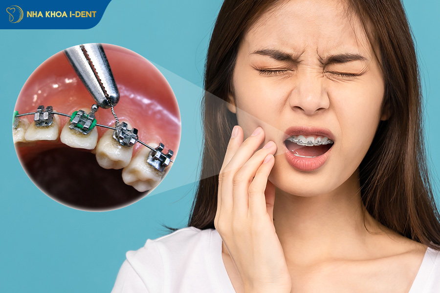 dây cung đâm vào má gây khó chịu và đau nhẹ
