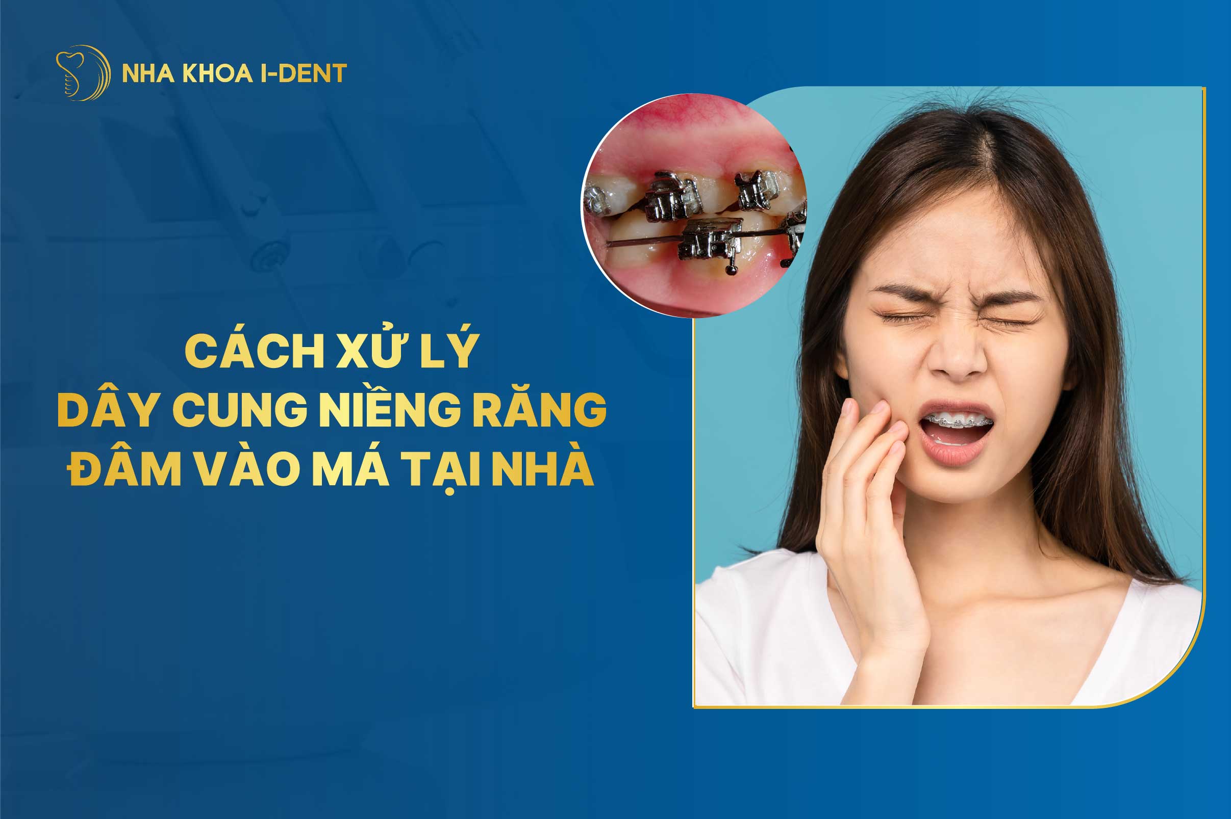 Hướng dẫn cách xử lý dây cung niềng răng đâm vào má